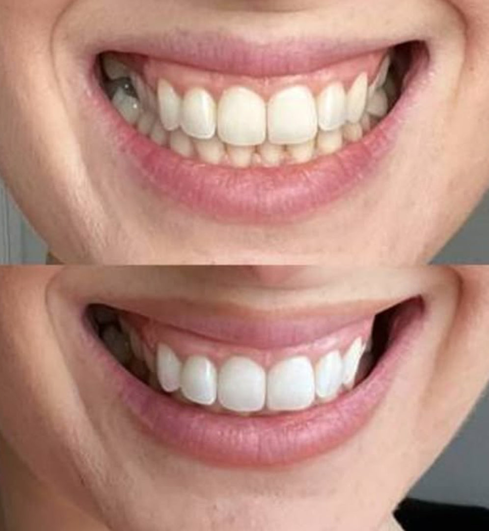 Dentifrice Siwak - Soin dentaire naturel