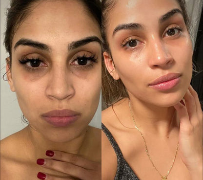 Nila 100% naturel - Anti-tâches